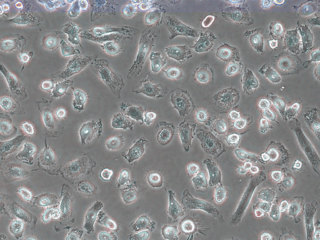 Human CD14+ Monocytes (From Mobilized Blood, 25 Million Cells)