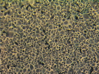 PrSC – Human Prostate Stromal Cells
