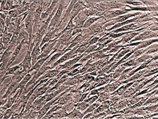 Human Bone Marrow CD34+ Progenitor Cells, Cryopreserved, 500,000