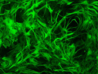 Rat Brain Cortex Astrocytes