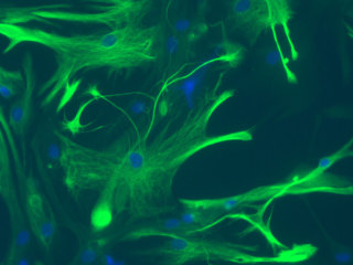 Mouse C57 Brain Mixed Astrocytes