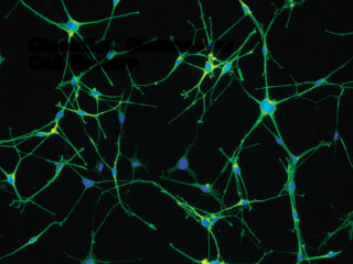 Endothelin-3 Growth Supplement (ET-3)