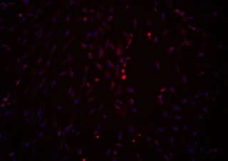 TGF Beta 3 for hMSC Chondrogenic Differentiation Kit