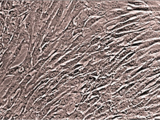 Human Bone Marrow Mononuclear Cells MNCs, Cryopreserved, 25 Million Cells