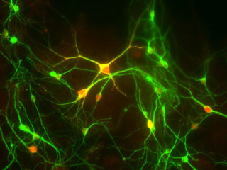 Rat Brain Cortex Neurons