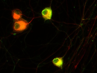 Rat Brain Cortex Neurons