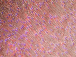 PASMC - Human Pulmonary Artery Smooth Muscle Cells