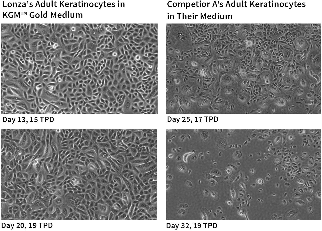 KGM™ Gold Keratinocyte Growth Medium SingleQuots™ Supplements and Growth Factors
