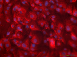 HMEC – Human Mammary Epithelial Cells