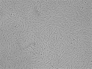 SAEC – Human Small Airway Epithelial Cells
