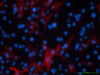 D-HBE-COPD &ndash; Diseased Human Bronchial/Tracheal Epithelial Cells &ndash; COPD for B-ALITM &nbsp; This product is no longer available for sale.
