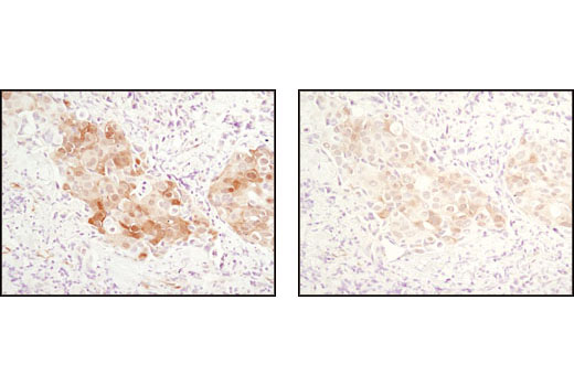 CST   Phospho-Akt (Ser473) (D9E) XP ® Rabbit mAb  4060T 4060L 4060S