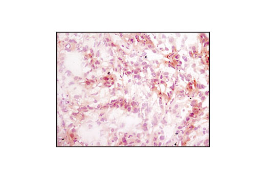 CST   Phospho-Akt (Ser473) (D9E) XP ® Rabbit mAb  4060S 4060T 4060L