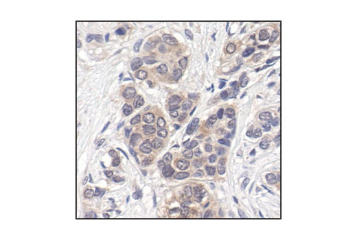 CST   p44/42 MAPK (Erk1/2) (137F5) Rabbit mAb  4695S 4695T