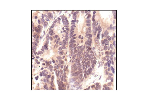 CST   p44/42 MAPK (Erk1/2) (137F5) Rabbit mAb  4695S 4695T