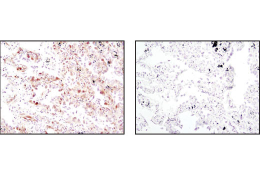 CST  Phospho-p44/42 MAPK (Erk1/2) (Thr202/Tyr204) (D13.14.4E) XP ® Rabbit mAb  4370S 4370L 4370T