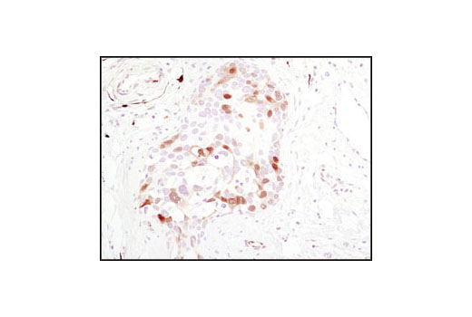 CST  Phospho-p44/42 MAPK (Erk1/2) (Thr202/Tyr204) (D13.14.4E) XP ® Rabbit mAb  4370S 4370L 4370T