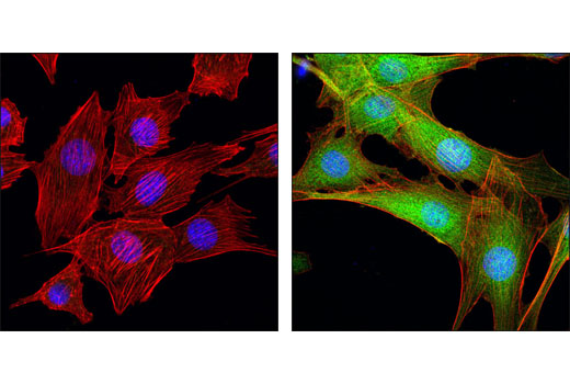 CST  Phospho-p44/42 MAPK (Erk1/2) (Thr202/Tyr204) (D13.14.4E) XP ® Rabbit mAb  4370S 4370L 4370T