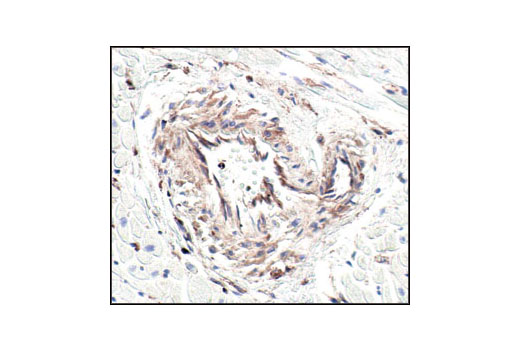 CST   beta-Actin (13E5) Rabbit mAb  4970S 4970L 4970T