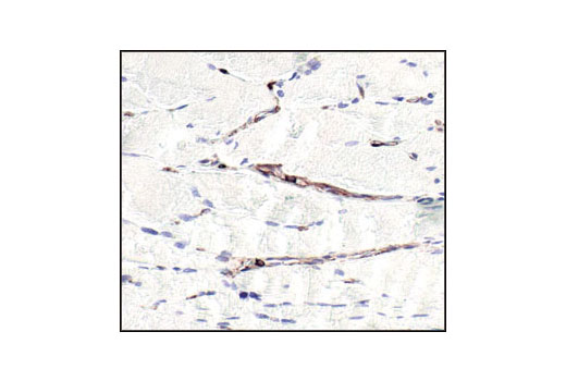 CST   beta-Actin (13E5) Rabbit mAb  4970S 4970L 4970T