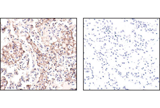 CST   beta-Actin (13E5) Rabbit mAb  4970S 4970L 4970T